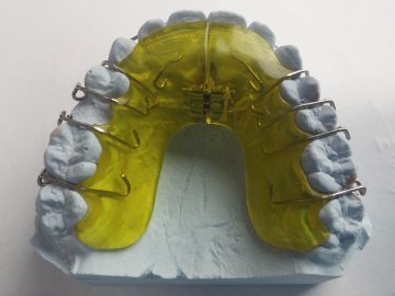 aparatos dentales